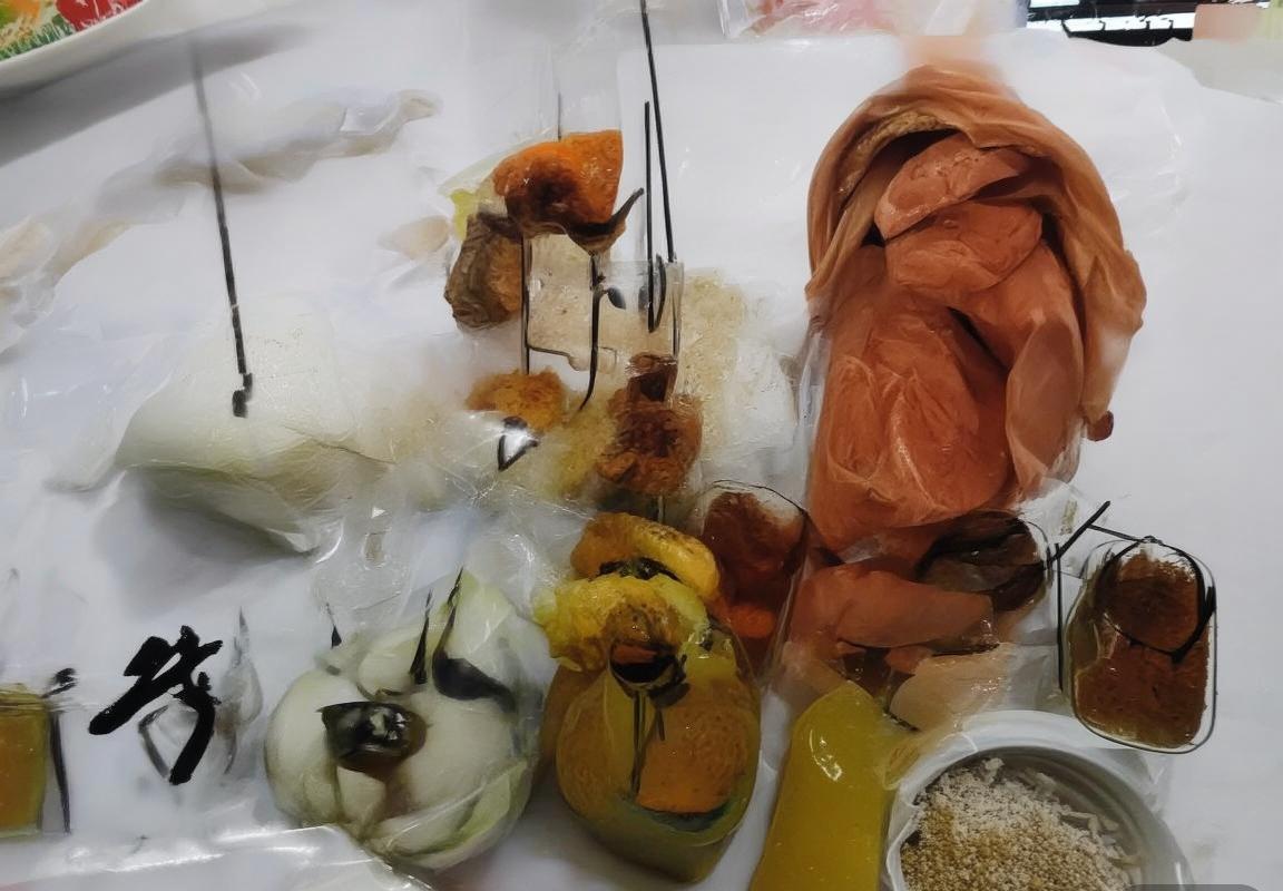 2015世界杯乒乓球巅峰对决：马龙水谷隼影响乒乓界深远(图3)